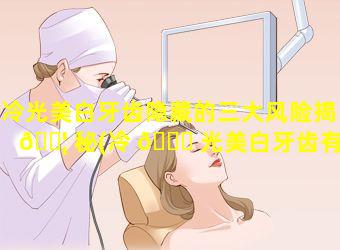 冷光美白牙齿隐藏的三大风险揭 🐦 秘(冷 🐅 光美白牙齿有没有副作用特别难受为什么)